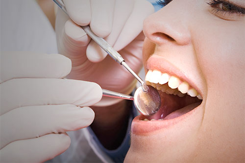 Keep Your Smile With Dental Cleanings